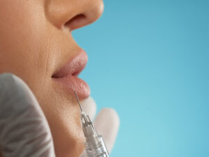 harmonização facial